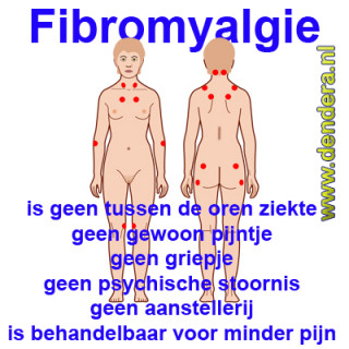 Fibromyalgie Fibromyalgie - Afbeelding